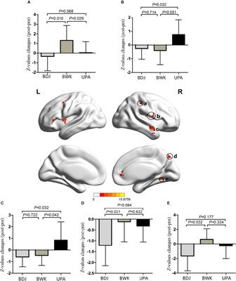 The Effect of Traditional Chinese Mind-Body Exercise (Baduanjin) and Brisk Walking on the Dorsal Attention Network in Older Adults With Mild Cognitive Impairment